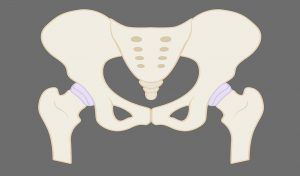 trabajos incompatibles con artrodesis lumbar